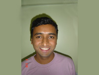 Picture After Clear aligner retainer Treatment in Pune